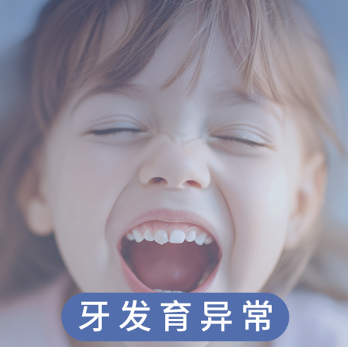 牙发育异常