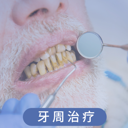 牙周治疗